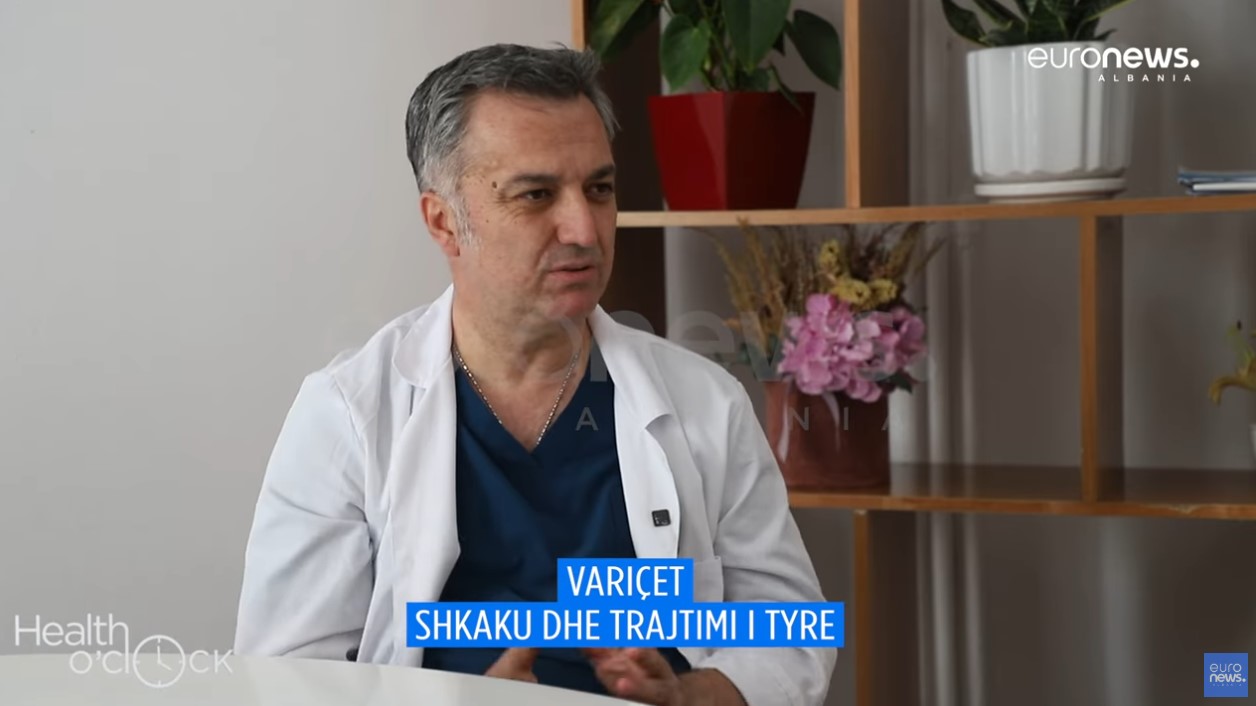 Gjithçka që duhet të dini për variçet, mjeku tregon shkaqet dhe trajtimin