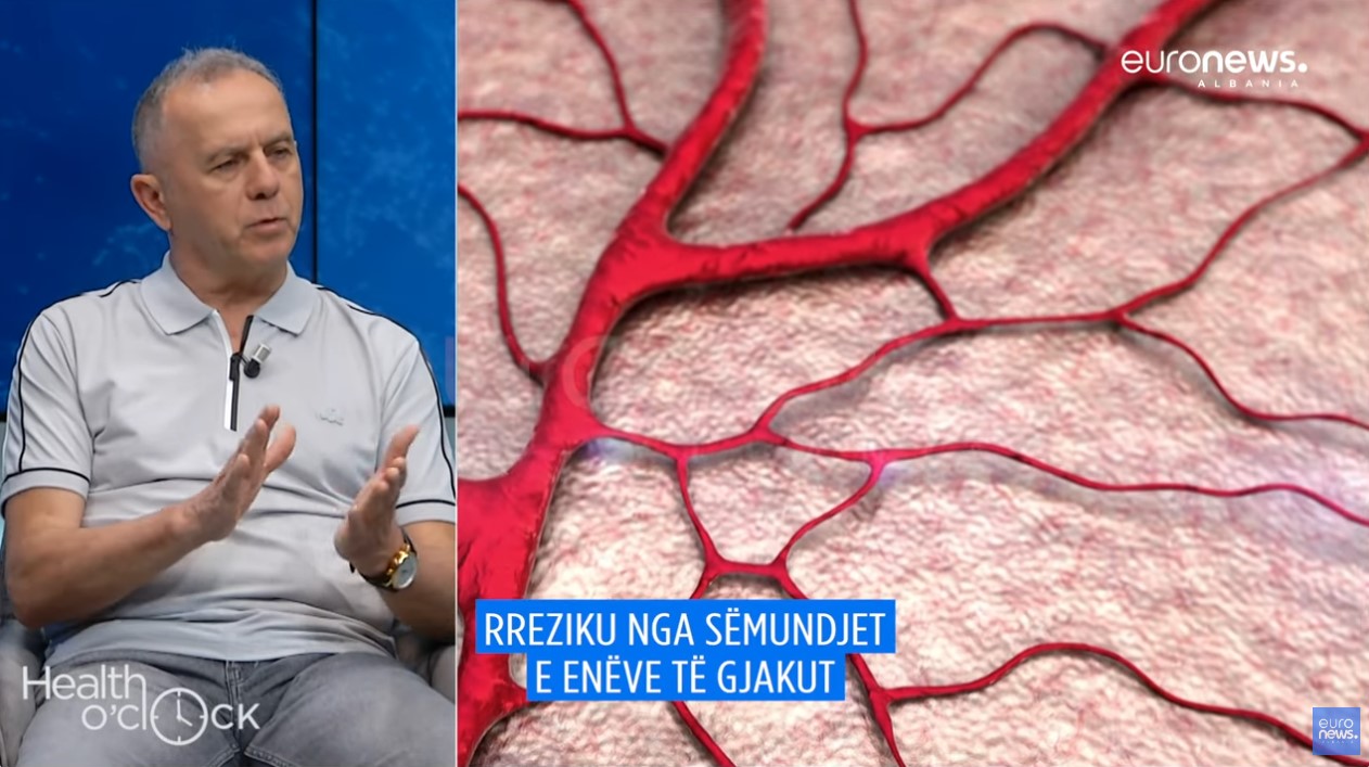 “Sëmundjet arteriale çojnë në gjymtim”, mjeku: Diagnostikimi i hershëm është jetik